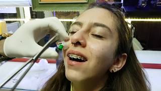 Septum Piercing Delimi  Septum Saklama [upl. by Shayne]