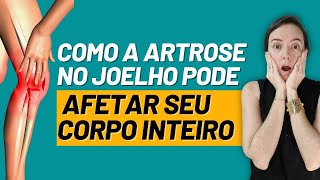 Como a Artrose no Joelho Pode Afetar Seu Corpo Inteiro [upl. by Meehar720]