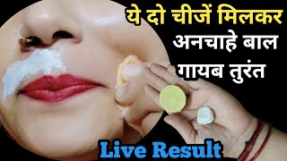 hard Chin hair👉पे सिर्फ इसे घिसके मोटे दिखे दाढ़ी मूछ पर लगाते ही गायब तुरंत😱 Facial Hair Removal [upl. by Brita]