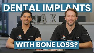 Dental Implants For People Who Have Been Told They Have No Bone [upl. by Naitsihc]