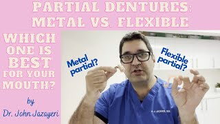 Metal Partial vs Flexible Partial Which Do You Choose [upl. by Aneehsram202]