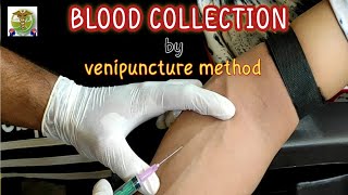 Blood collection by venipuncture method l How to collect venous blood l safe and effective way [upl. by Enywtna]