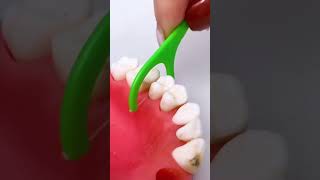 Best tool for teeth shortsvideo [upl. by Had779]