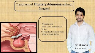 Pituitary Adenoma  Non Surgical treatment Cure without Operation Prolactinoma By Dr SkandaNSx [upl. by Nwahsak]