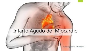 infarto de miocardio Fisiopatología [upl. by Aylmer]