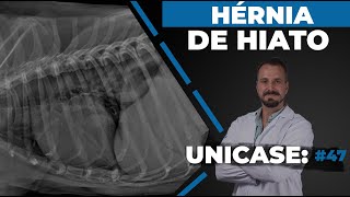 UNICASE 47  Hérnia de hiato [upl. by Harleigh582]