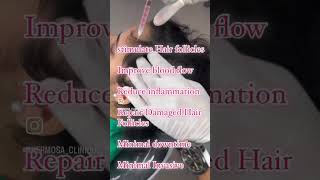 BOOST YOUR HAIR GROWTH WITH HAIR EXOSOMES hermosaclinique haircut youthfulglow baldhead hair [upl. by Suu]