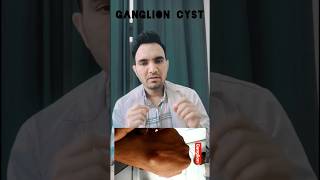 Ganglion cyst Treatment trendingshorts viralvideo shorts medical surgery yt shortsvideo [upl. by Chilton]