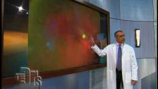 The Optomap® Retinal Exam on The Doctors [upl. by Llednov289]