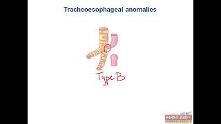 Gastroenterology GIT embryology video from USMLE First Aid Step One 1 [upl. by Emelia]