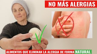 Como Eliminar Tu Alergia  Crema Natural para aliviar la picazón fácil y econóimica [upl. by Slein]