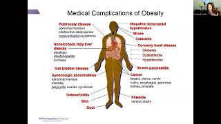 5122023 Challenges with Obesity with Chronic Disease in the Population [upl. by Esinyl]