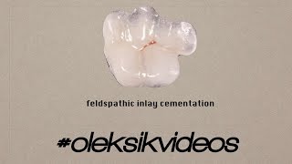 inlay cementation [upl. by Carnes]