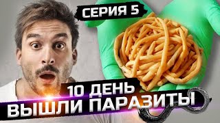 Что делать чтобы вышли паразиты серия 5 сезон 1 [upl. by Eniowtna]