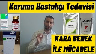 KURUMA HASTALIĞIKARA BENEK TEDAVİ YÖNTEMİ Nelerdir Karabenek ve kuruma ilaçlarını nasıl kullanılır [upl. by Lomaj]