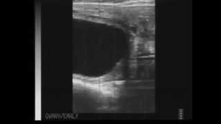 Ultrasound Quiz  Pregnant or Open questions [upl. by Bowe602]