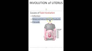 Obstetrics Causes of subinvolution Uterus Viva [upl. by Mimajneb]