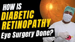 Diabetic Retinopathy Treatment  Pars Plana Vitrectomy PPV Eye Surgery for Diabetic Retinopathy [upl. by Calica]