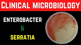 Enterobacter Cloacae amp Serratia Marcescens ClinicalPathogenesisInvestigationsTreatment Prevention [upl. by Cohin]