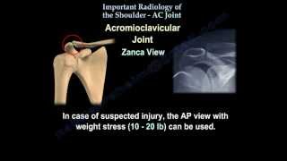 The Shoulder AC JOINT radiology  Everything You Need To Know  Dr Nabil [upl. by Scholz]