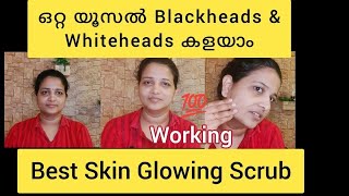 ഒറ്റ യൂസിൽ Blackheads Whiteheads കളയാം 100 result ഉറപ്പാണ് The Beauty Room [upl. by Gunter]