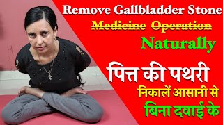 Gallbladder Stones  Remove Naturally l Gallstones l Gallbladder Pain l Healthcity [upl. by Sybille]