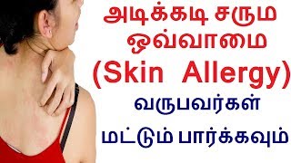 அடிக்கடி சரும ஒவ்வாமை Skin Allergy வருபவர்கள் மட்டும் பார்க்கவும்  Remedies for skin rashes tamil [upl. by Cutty]