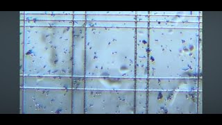 Yeast Cells on Counting Slide [upl. by Bradwell921]