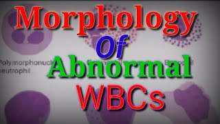 Leukocyte Abnormalities and Disorders  Abnormal Leukocyte MorphologyDisorders of White Blood Cells [upl. by Sam]