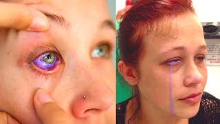 Model Goes Blind Getting Her Eyeballs Tattooed [upl. by Garik771]