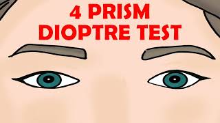 4 PRISM DIOPTRE TEST [upl. by Naut]