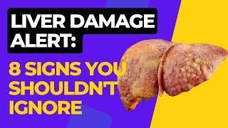 Liver Damage Alert 8 Signs You Shouldnt Ignore [upl. by Supat]