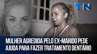 Mulher agredida pelo exmarido pede ajuda para fazer tratamento dentário [upl. by Atteroc]