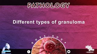 Tut 1 Part 2Different types of Granuloma Pathology [upl. by Goldenberg]