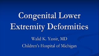 Congenital Lower Extremity Deformities  Dr Yassir [upl. by Barmen885]