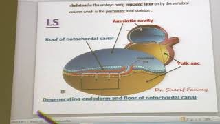 General embryology 14  Formation of the notochord  by Dr Wahdan [upl. by Ayouqes517]