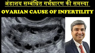 अंडाशय सम्बंधित गर्भधारण की समस्या  OVARIAN CAUSE OF INFERTILITY [upl. by Asikal209]