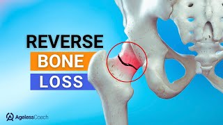 Top 4 Natural Ways To Fix Osteoporosis Reverse Bone Loss [upl. by Nirehs]