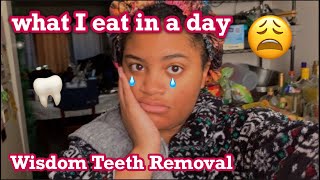 what I eat in a day ❂ WISDOM TEETH EDITION 4 days post op [upl. by Rube806]