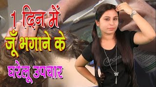 1 दिन में जूँ भगाने के घरेलू उपचार Home Remedies For Head Lice  Juon Ko Bhagane Ke Upchar  Tips [upl. by Nniw640]