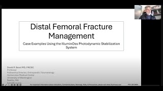 IlluminOss as an augment in the distal femur to aid in early weight bearing Dr Barei amp Dr Mirza [upl. by Estes]