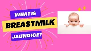 Breastmilk jaundice Breastfeeding jaundice Dr Sridhar K bilirubin neonataljaundice breastmilk [upl. by Jenni943]