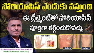 Causes Of Psoriasis In Telugu  Psoriasis Skin Disease Treatment In Telugu  Ayurvedic Treatment [upl. by Weiser]