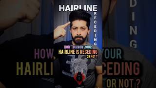 HOW TO KNOW YOUR HAIRLINE IS RECEDING OR NOT  shorts youtubeshorts menshair hairloss hairtips [upl. by Solange]