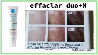 effaclar duo M 2024 منتج رائع ضد حب الشباب و اثاره و لكن ضروري من الاستعمال الصحيح [upl. by Adela]