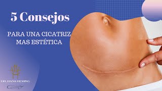 Cómo Mejorar tus Cicatrices 5 Consejos Efectivos para una Cicatrización Estética [upl. by Atolrac]