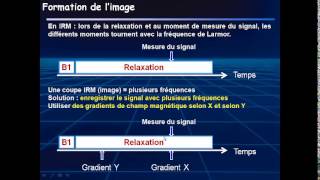 IRM PCEM2 [upl. by Obrien]