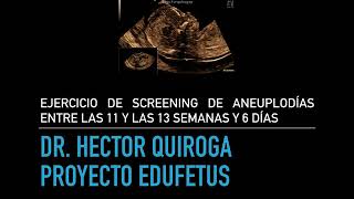 Screening de aneuploidías entre las 11 y las 13 semanas y 6 días Uso de la calculadora de riesgo [upl. by Ahsinhoj]