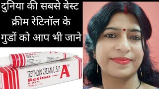 चेहरे की सारी समस्या खत्म My experience and review of retinoA cream झाइयो के लिए की अनोखी क्रीम [upl. by Ainafets]