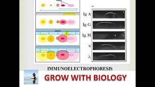 IMMUNOELECTROPHORESIS IN HINDI [upl. by Dorahs508]